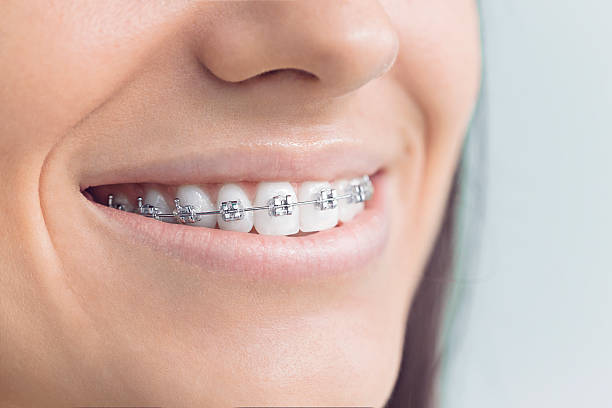 Best Wisdom Tooth Removal  in Camp Swift, TX